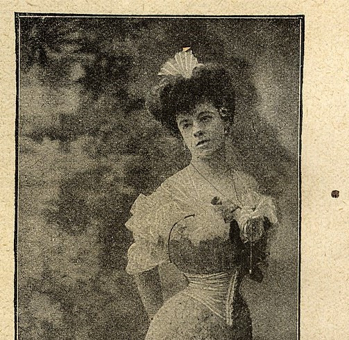 Historien om Dina Alma de Paradera, døpt Alfredo, ble formidlet i norske aviser. Foto: Først publisert i Hermaphroditimus bein Menschen av Franz von Neugebauer (1908).